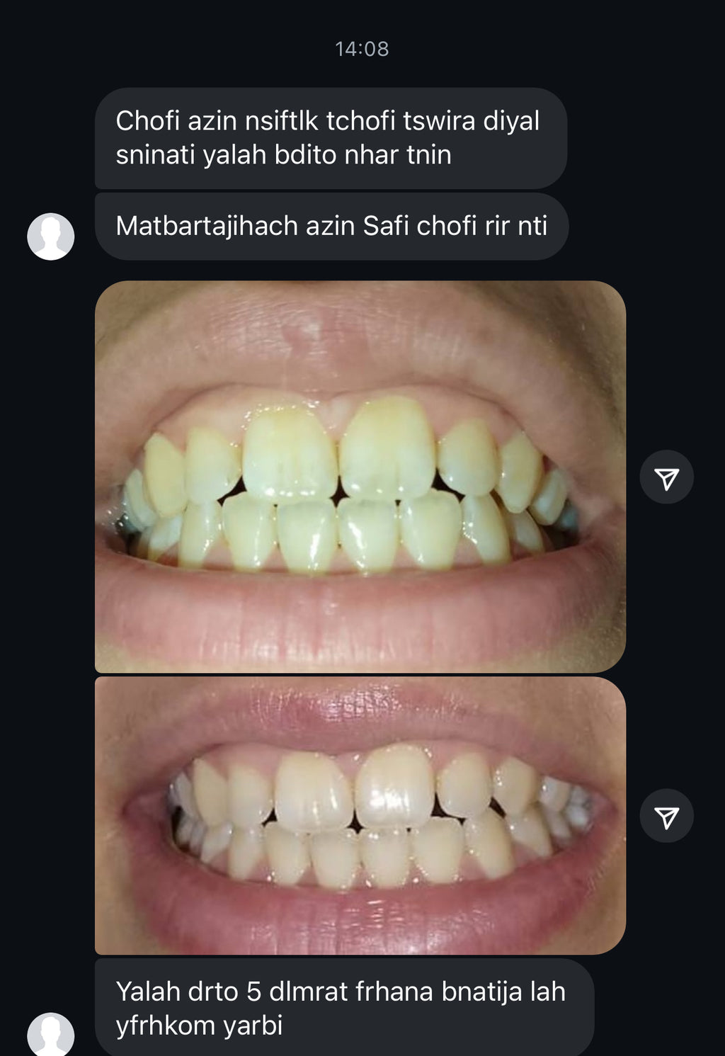 مبيض الاسنان و معالج اللثة