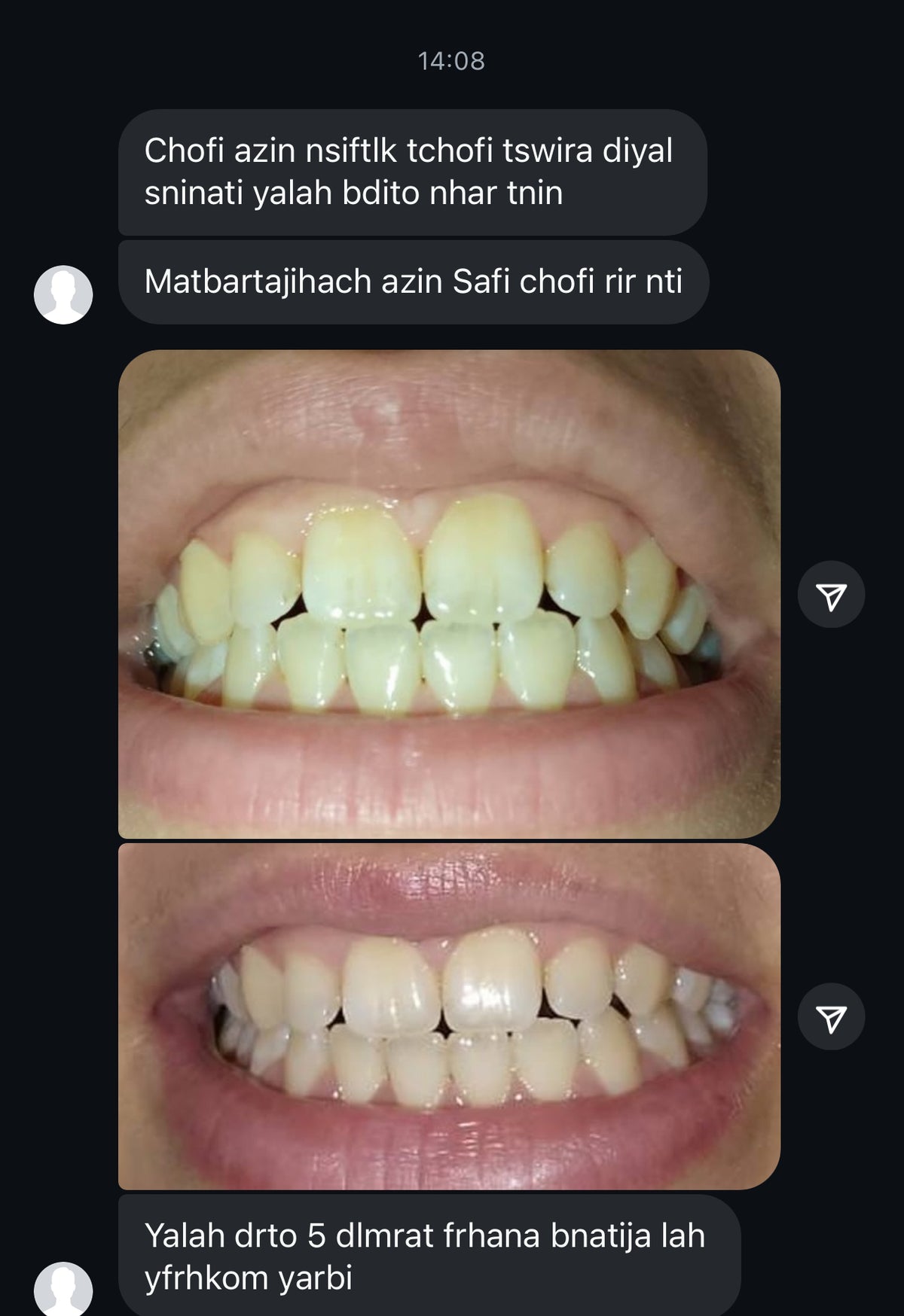 مبيض الاسنان و معالج اللثة