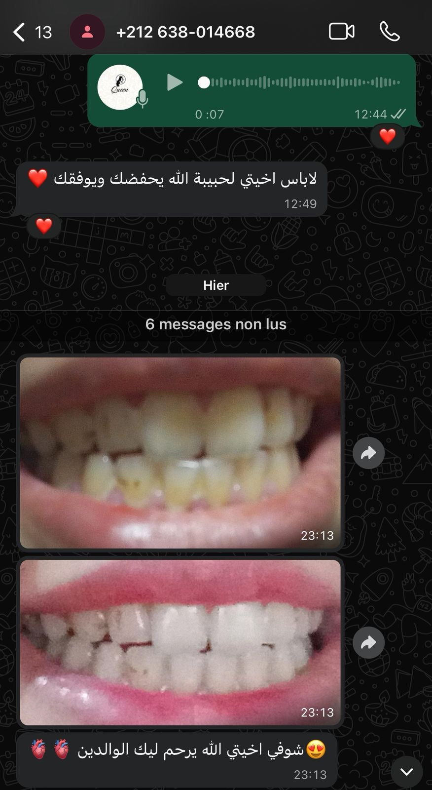 مبيض الاسنان و معالج اللثة