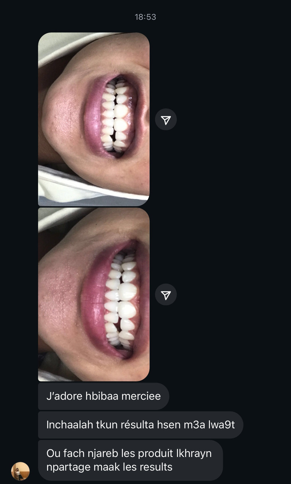 مبيض الاسنان و معالج اللثة