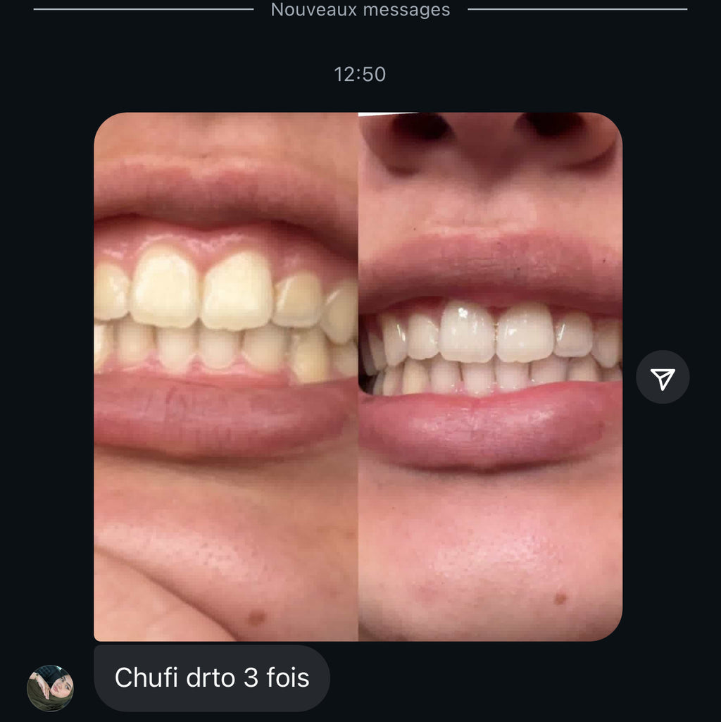 مبيض الاسنان و معالج اللثة