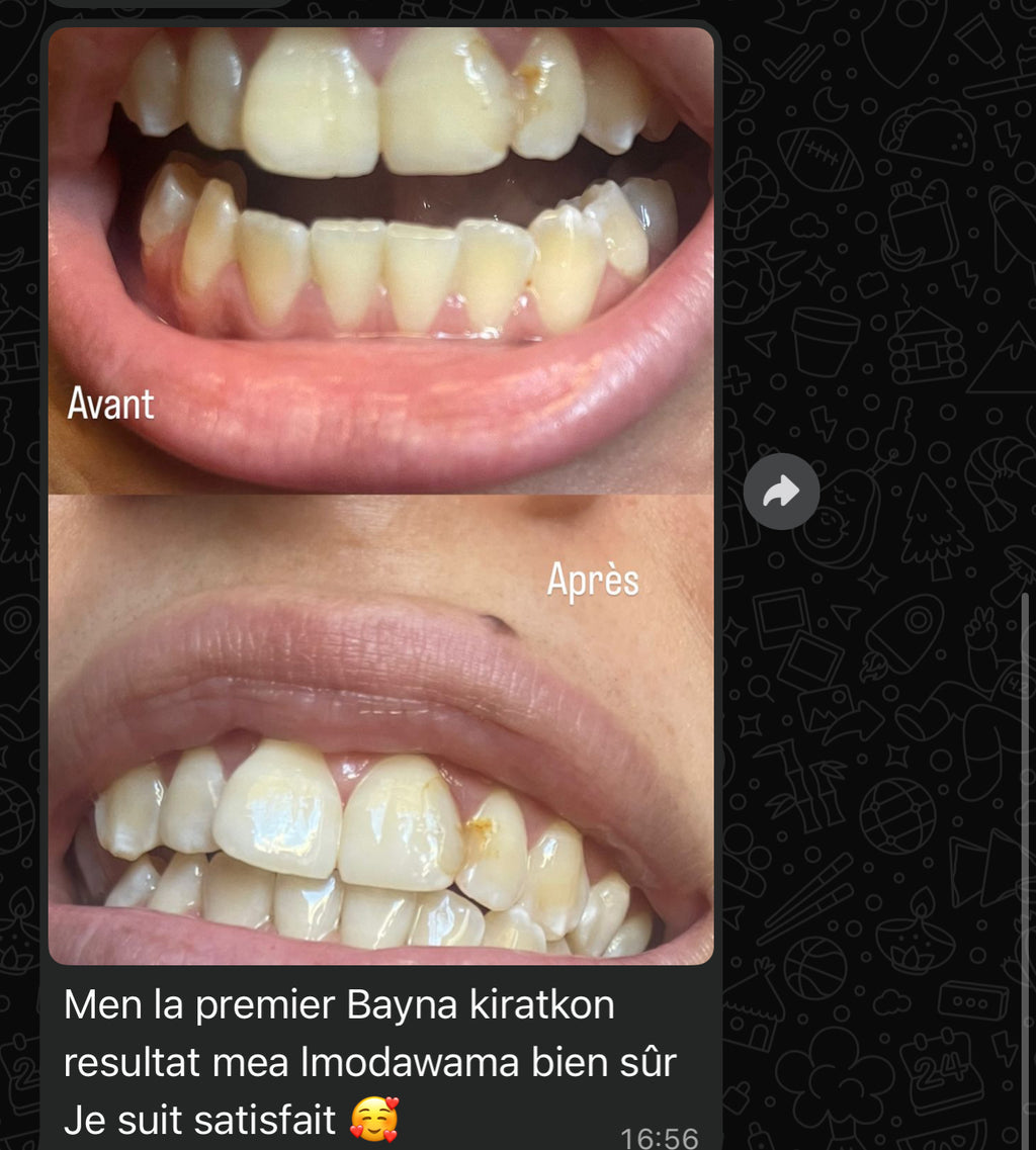 مبيض الاسنان و معالج اللثة