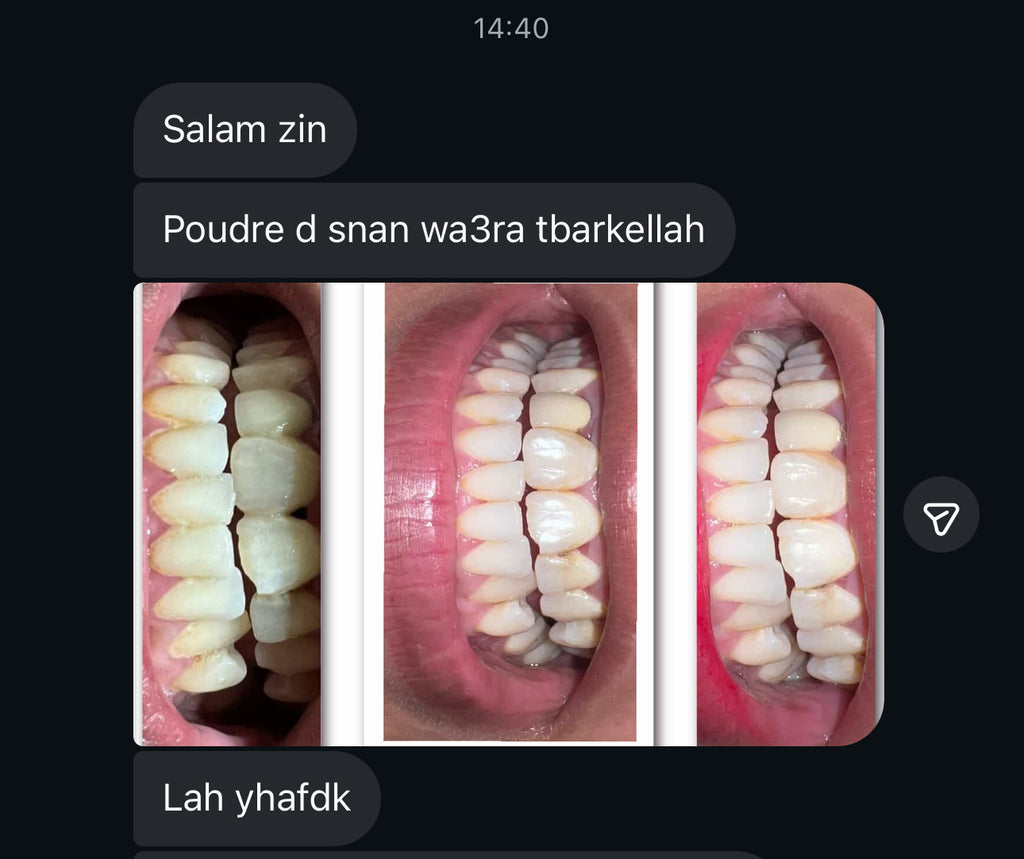 مبيض الاسنان و معالج اللثة