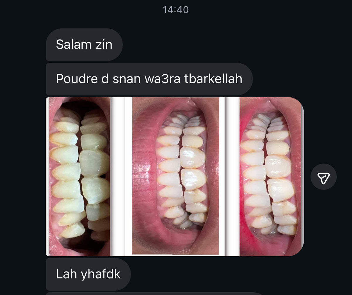 مبيض الاسنان و معالج اللثة