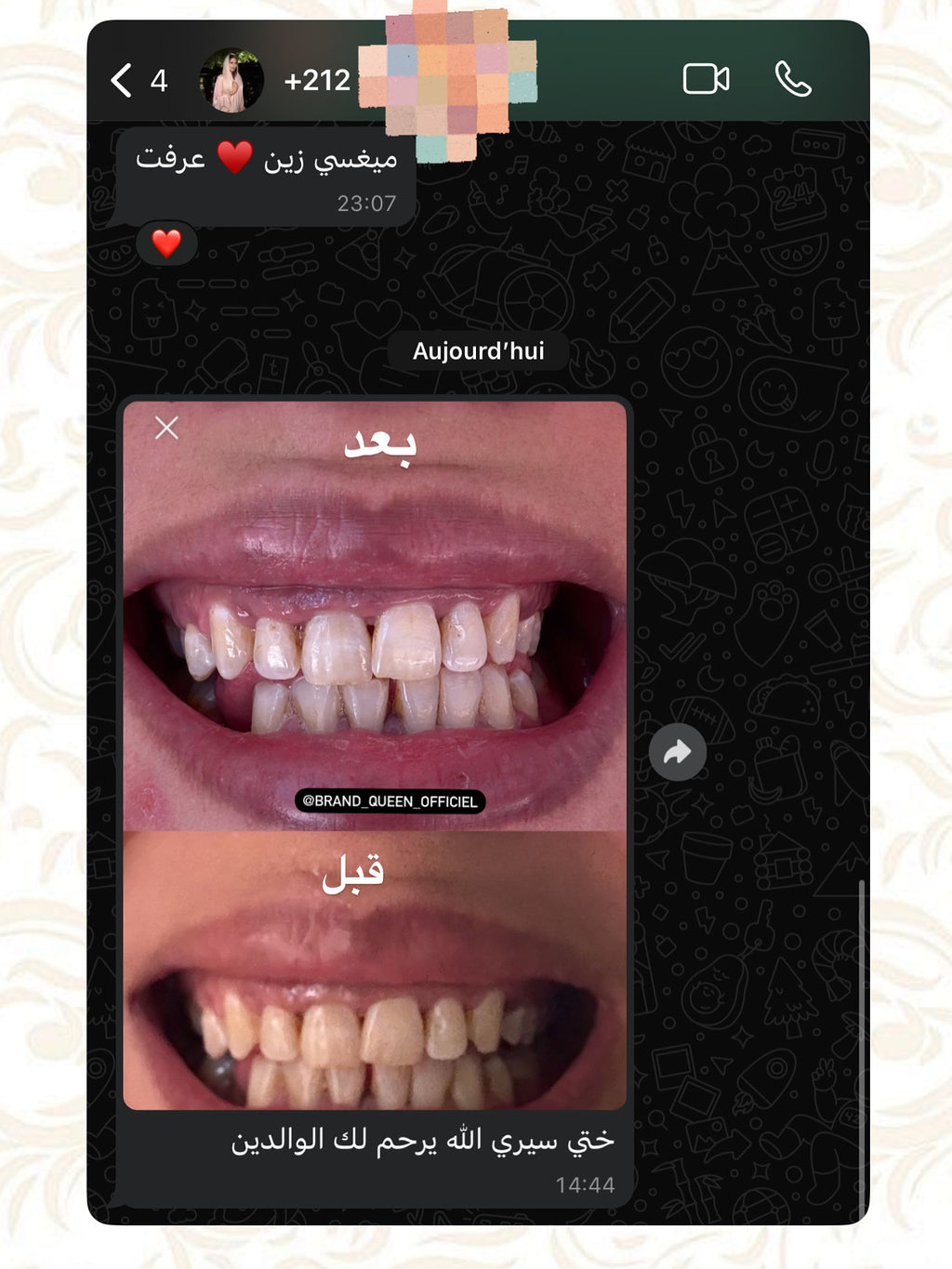 مبيض الاسنان و معالج اللثة