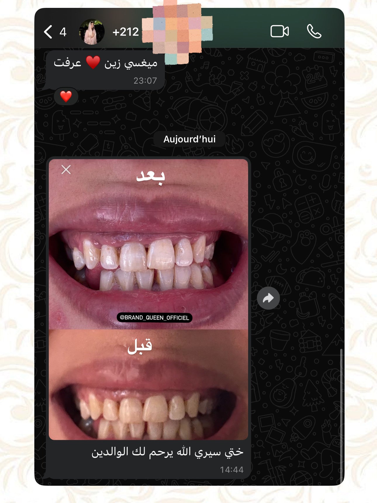 مبيض الاسنان و معالج اللثة